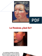 Tratamientos Para La Rosacea - Tratamiento Para Rosacea, Piel Con Rosacea