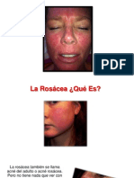 Rosacea en La Nariz - Rosacea Leve, Rosacea Enfermedad, Curar Rosacea