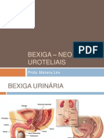 Bexiga _ Neoplasias Uroteliais