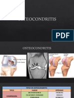 OSTEOCONDRITIS