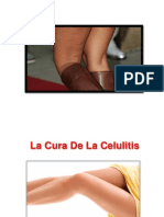 Quitar Celulitis, Como Se Quita La Celulitis, Piernas Con Celulitis, Acabar Con La Celulitis