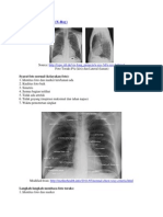 Membaca Foto Toraks
