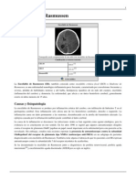 Encefalitis de Rasmussen PDF