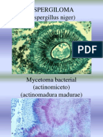 INFECCIONES MICÓTICAS