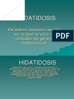 Hidatidosis Hep