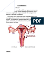 Endometriose-1