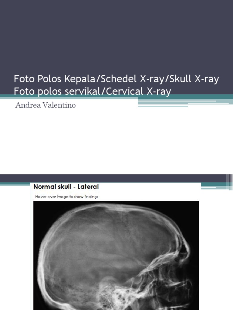 Skull Cervical X Ray Pdf