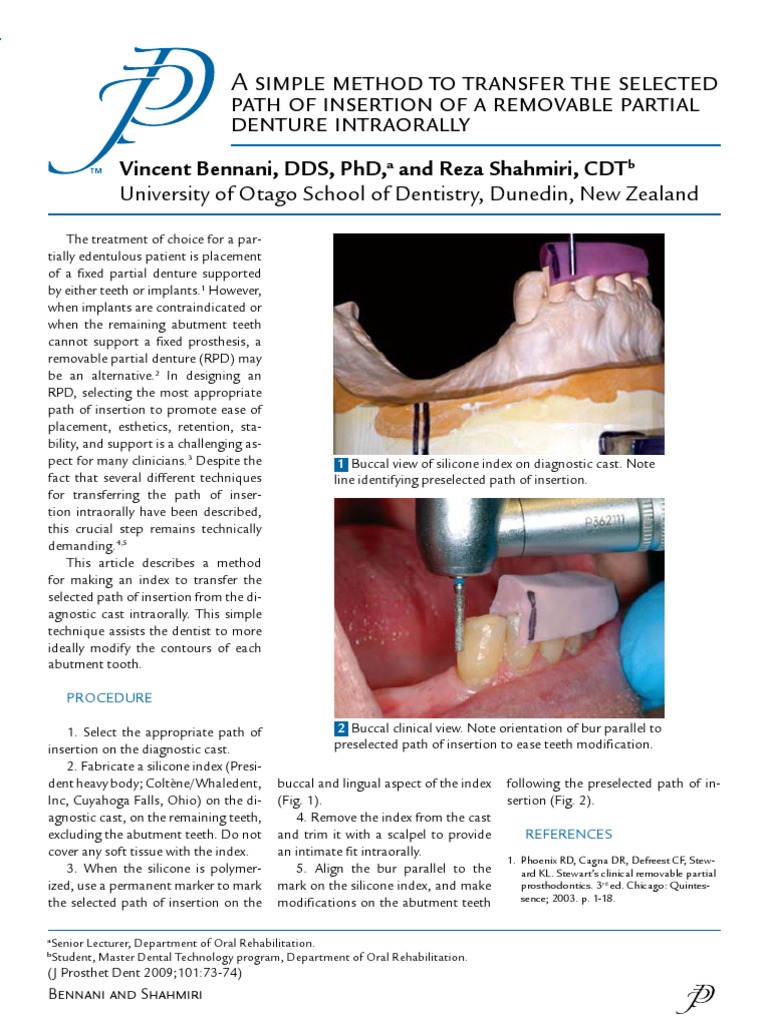 A Simple Method to Transfer the Selected Dental Implant Dentures