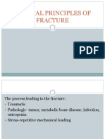 General Principles of Fracture