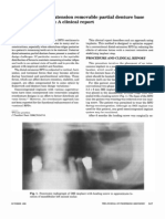 Solving The Distal Extension Removable Partial Denture Base Movement Dilemma