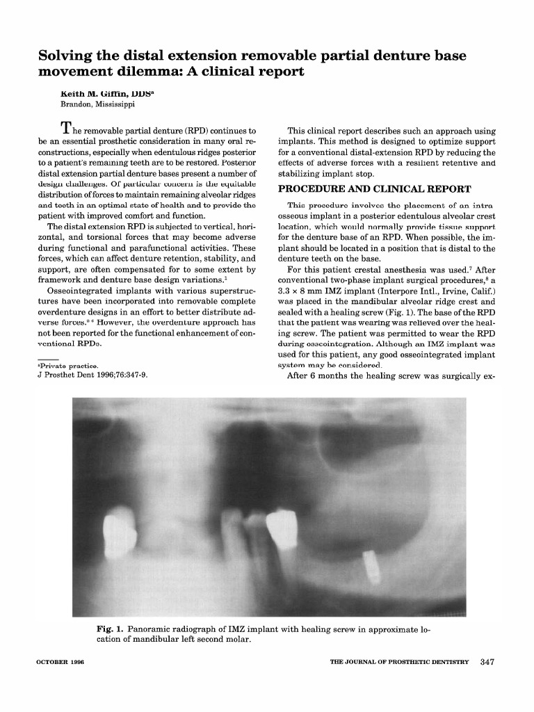 Solving The Distal Extension Removable Partial Denture Base Movement Dilemma Dental Implant Dentures