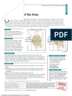 Osteoarthritis of The Knee: Jama Patient Page