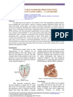 WPW Syndrome presented as VT