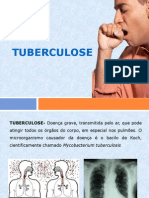 Tuberculose: Sintomas, Causas e Tratamento