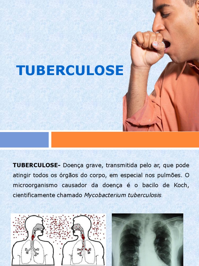 Radiografía de Tórax: Proceso Explicado Paso a Paso, image size:768x1024