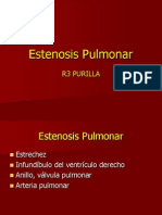 Estenosis Pulmonar788888888888888888888