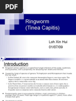 Download Ringworm Tinea Capitis by farmasi_hm SN21998450 doc pdf