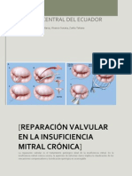 Reparación Valvular en La Insuficiencia Mitral Crónica