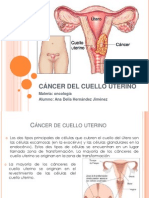 00cáncer Del Cuello Uterino