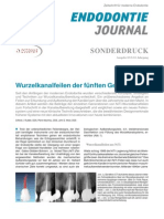 130603 PROTAPER NEXT Ruddle Endodontie Journal 2-2013 Sonderdruck
