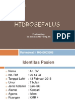 hidrosefalus