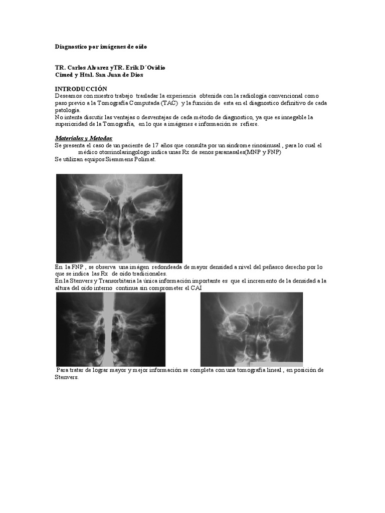 Radiología y TAC del oído interno | PDF | Ct Scan | Anatomía humana