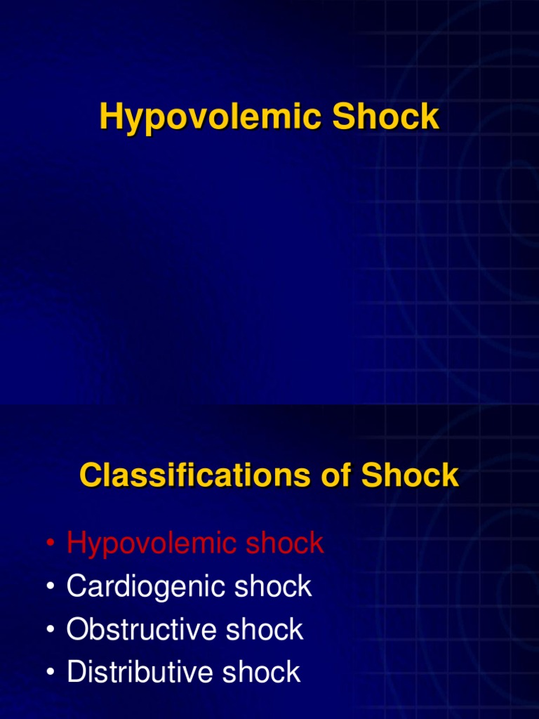 Hypovolemic Shock Shock (Circulatory) Dehydration