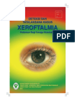 xeroftalmia