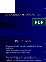 Ischaemia Heart