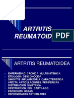 ARTRITIS REUMATOIDEA