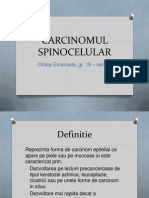 Carcinomul Spinocelular