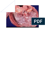 Degeneracion Valvular Por Defectos en Cuerdas Tendinosas EQUINOS