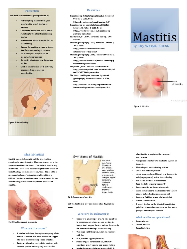 Teaching Plan Mastitis Breastfeeding Diseases And Disorders