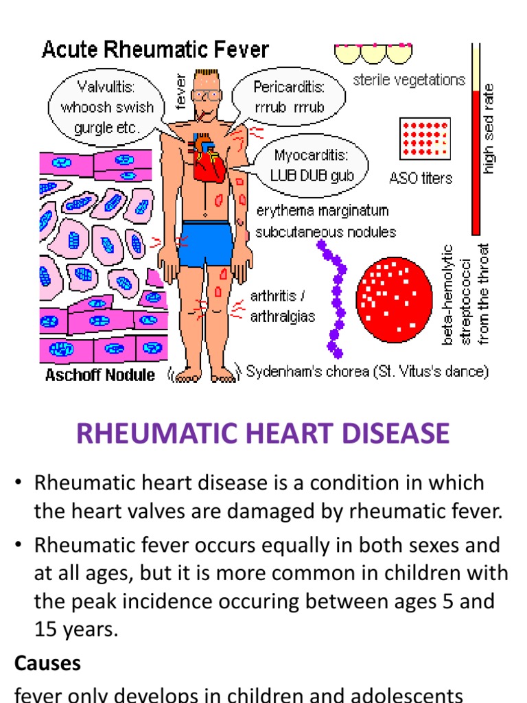 Rheumatic Heart Disease | PDF | Heart Valve | Anatomy