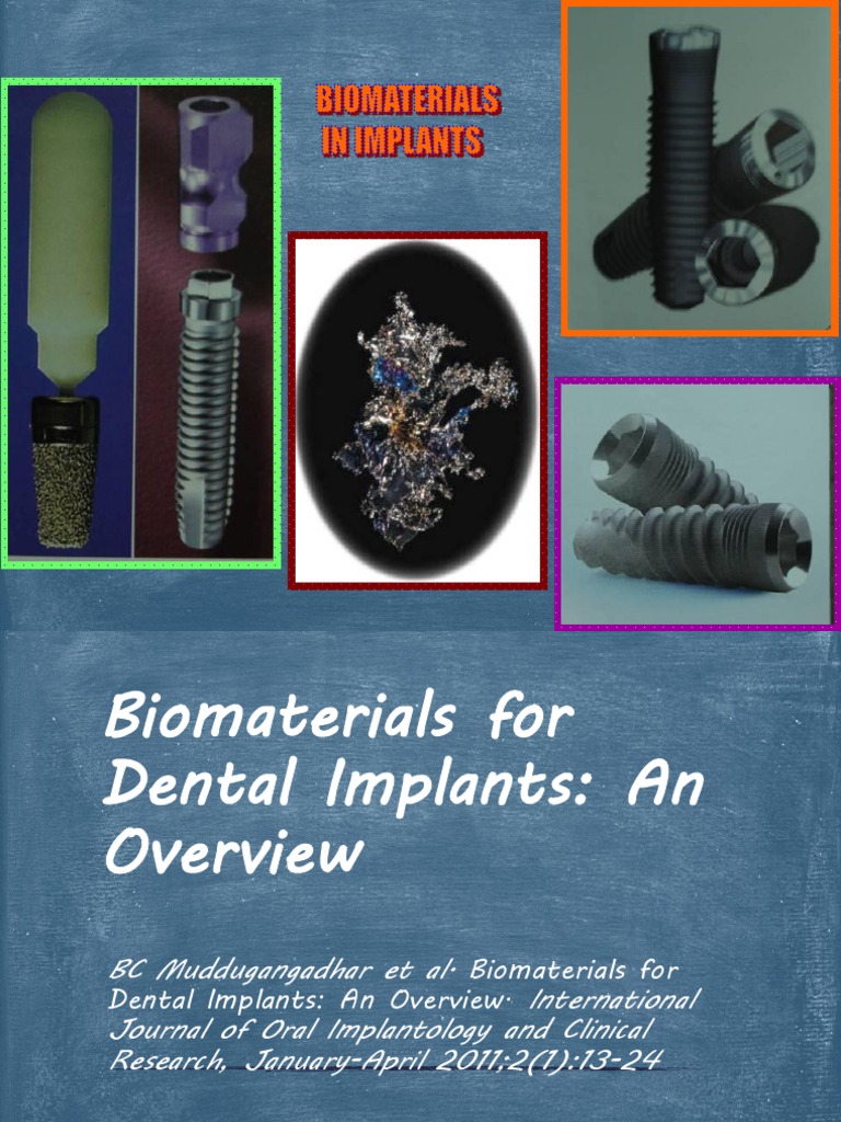 Biomaterials for Dental Implants Overview | PDF | Titanium | Corrosion