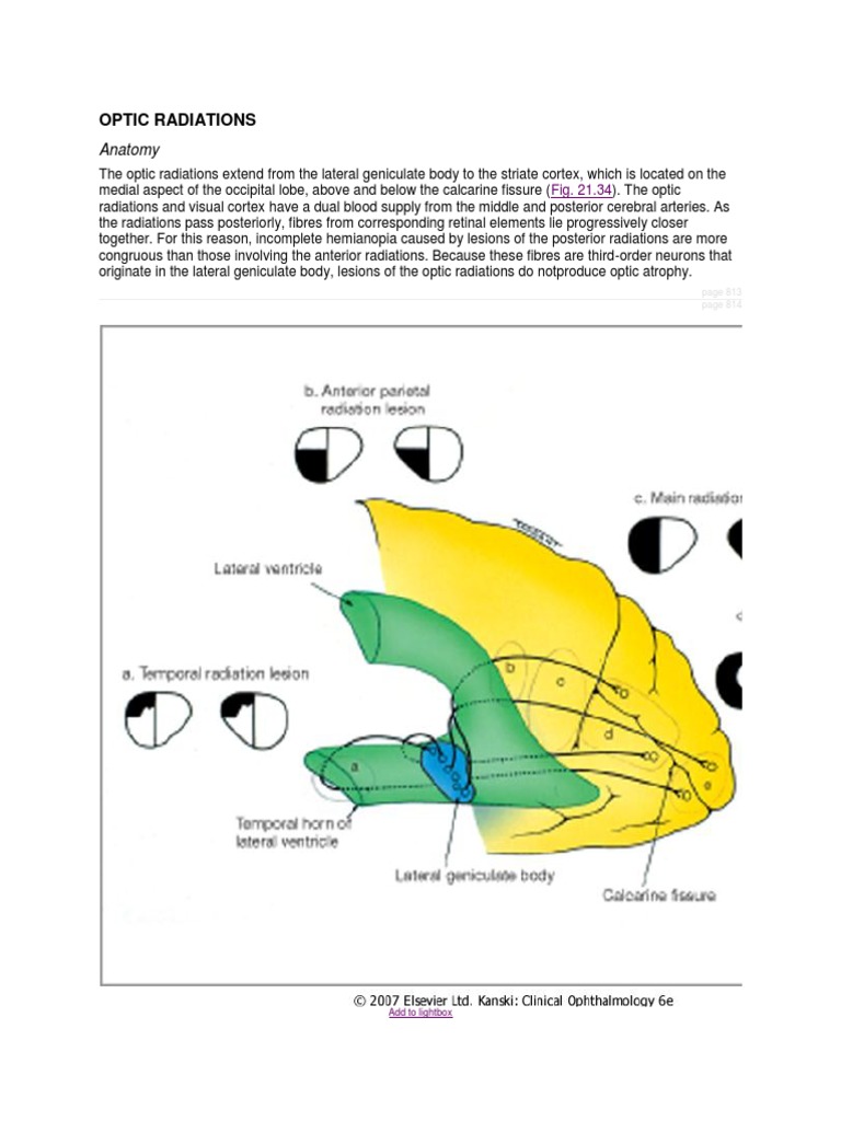 5 Optic Radiations | PDF | Parietal Lobe | Occipital Lobe