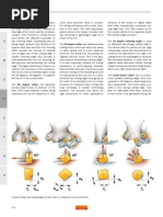 LTX 1040 Service Manual | Belt (Mechanical) | Tractor