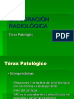 Exploración Radiológica Torax Patológico