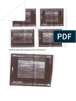 Appendix Normal Finding