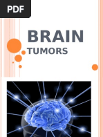 Download Brain Tumors PPT by rockmani SN22180392 doc pdf