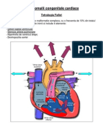 Anomalii congenitale cardiace