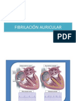 Fibrilación Auricular