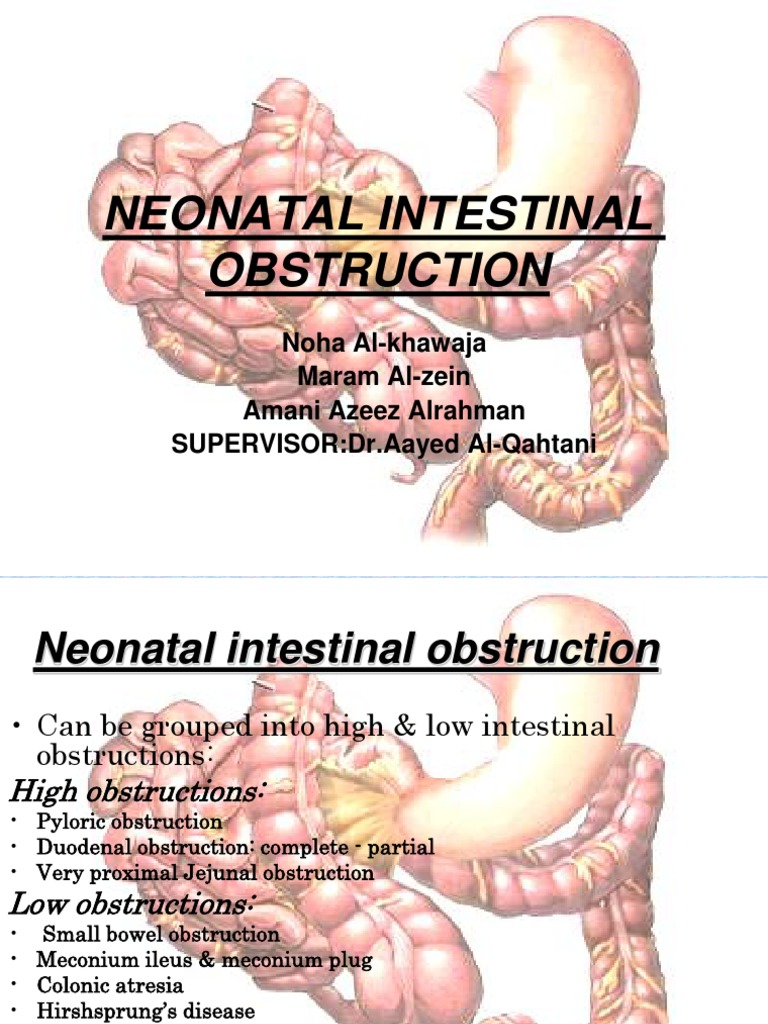 neonatal-intestinal-obstruction-pancreas-gastroenterology