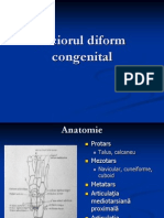 Piciorul Diform Congenital