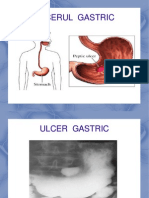 Ulcerul Gastric Studenti an 4