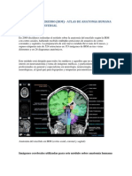 Anatomía Del Cerebro