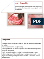 Hiperemia y Congestión2