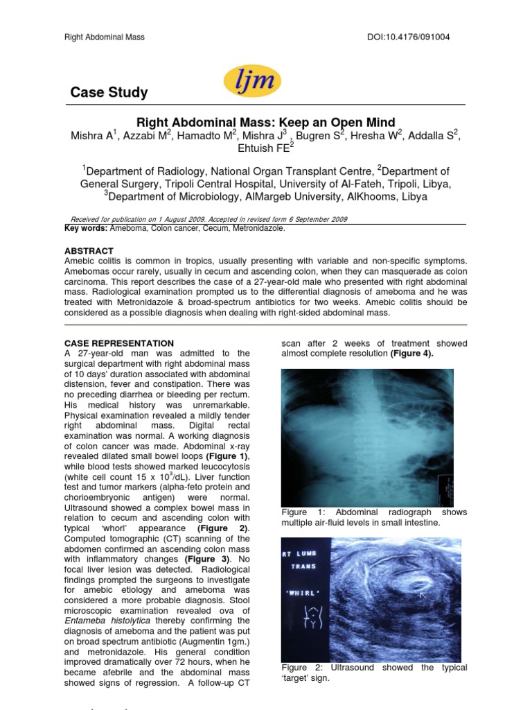 How long is the large intestine picture