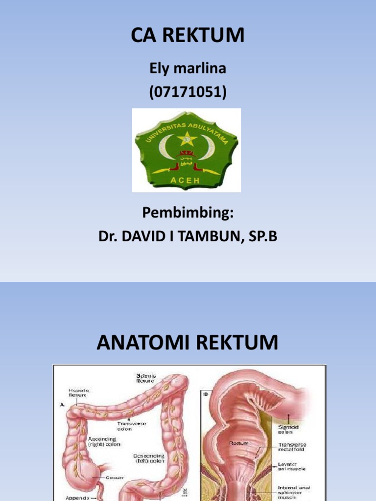 Kanker Rektum: Anatomi dan Penanganan | PDF