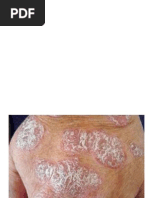 Contoh pemeriksaan Odontogram